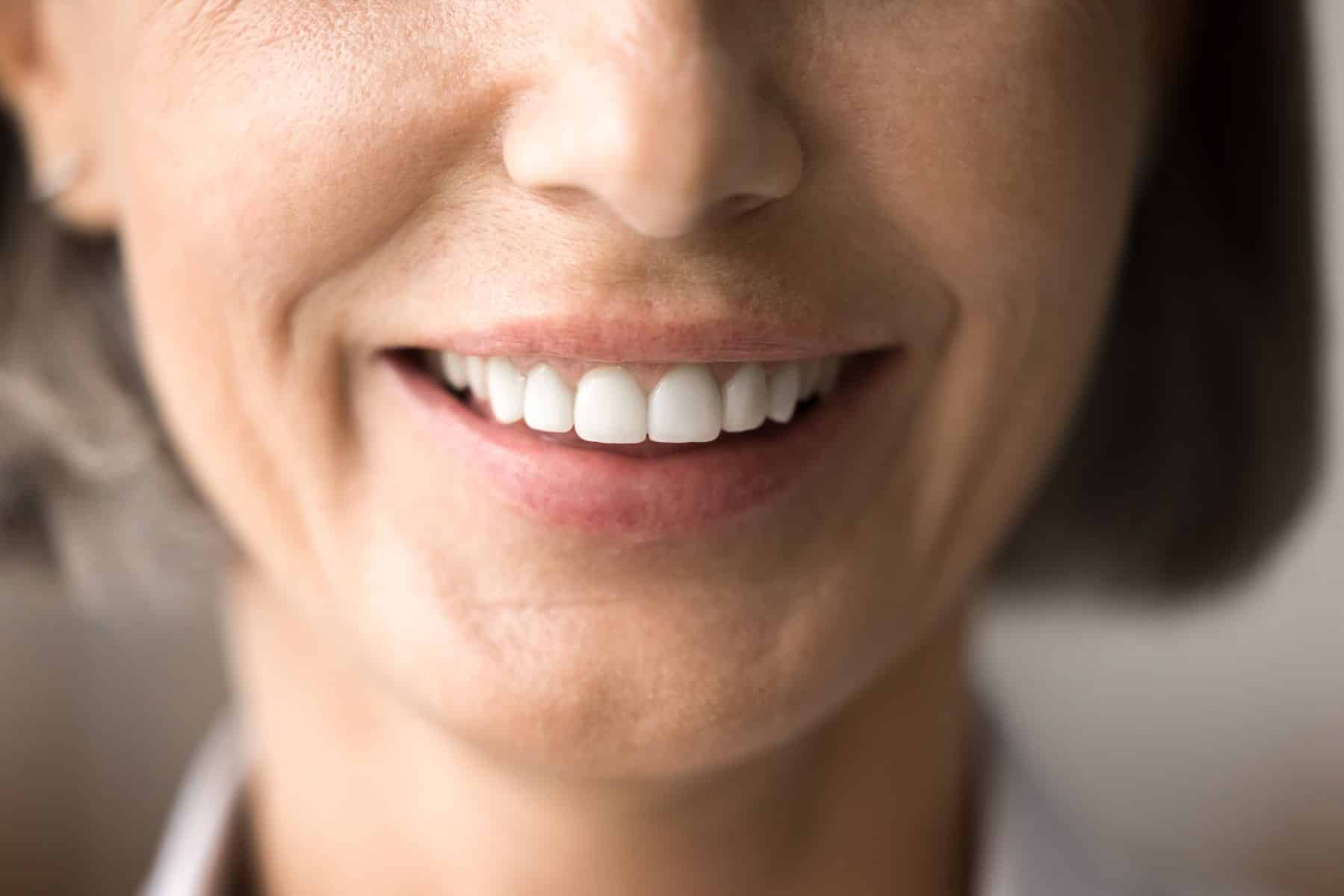 Woman smiling after orthodontic treatment in Battle Creek, MI